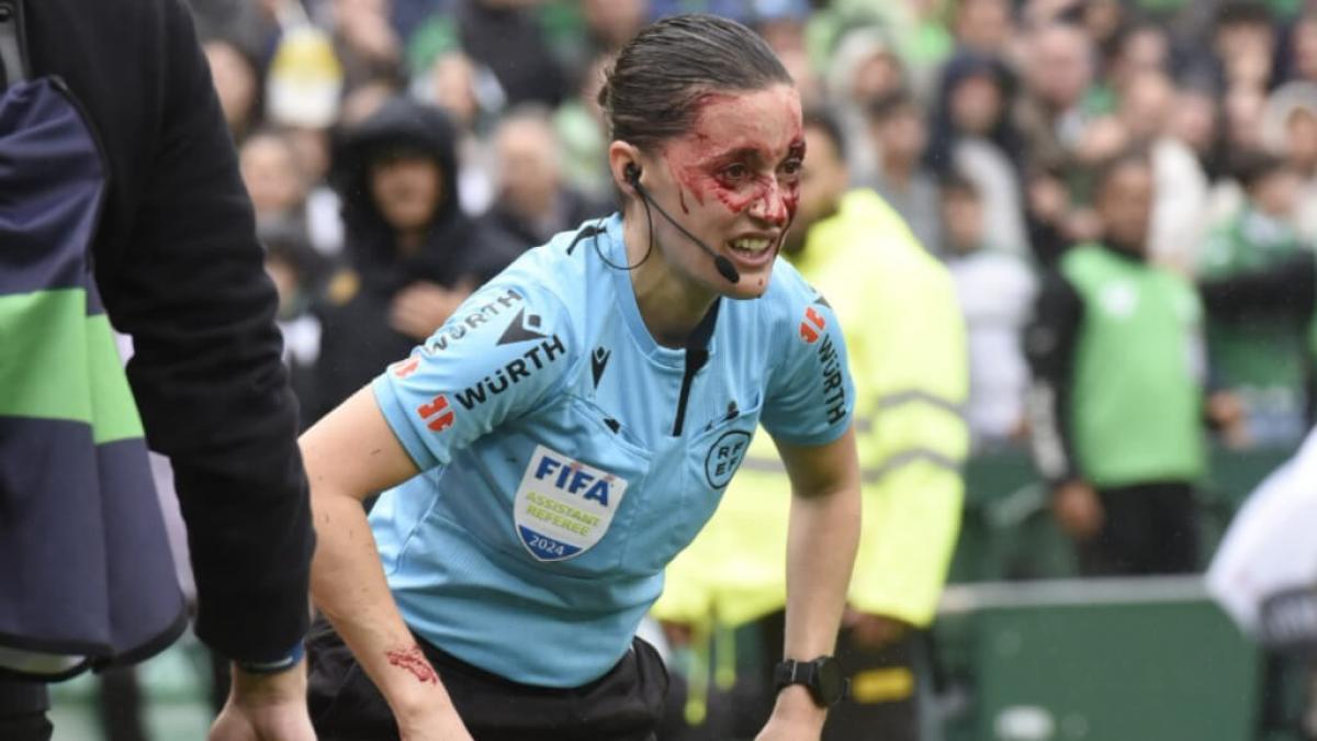 إصابة غريبة في مباراة للدوري الإسباني لكرة القدم